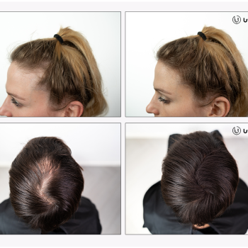 UVI Hair vlakna za kosu, DARK BROWN / Tamno smeđa (velika 27,5 g, do 50 nanosa)